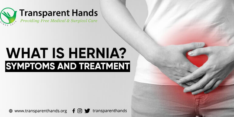 Femoral Hernia - Causes, Risk Factors, Symptoms, Complications & Treatment  - Pristyn Care