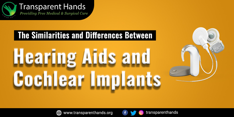 Hearing Aids And Cochlear Implants Similarities And Differences 0127